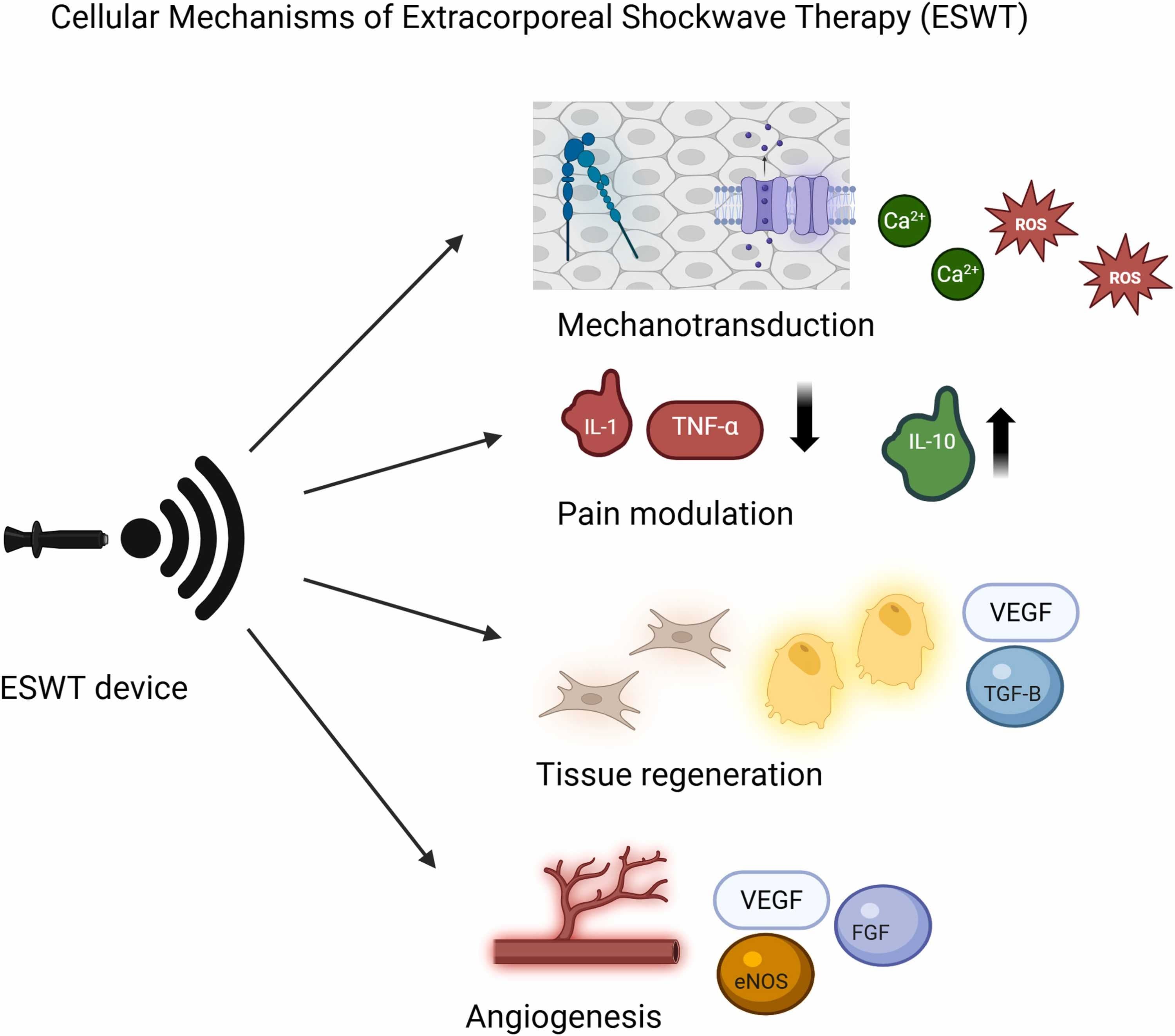 Shockwave pathophysiology mechanism diagram