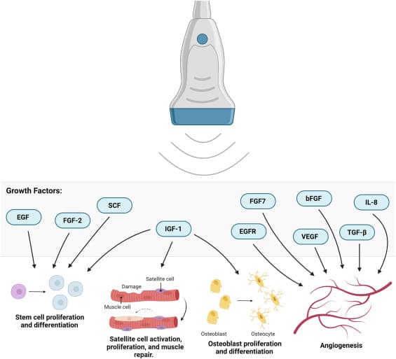 Ultrasound pathophysiology and tissue absorption mechanisms