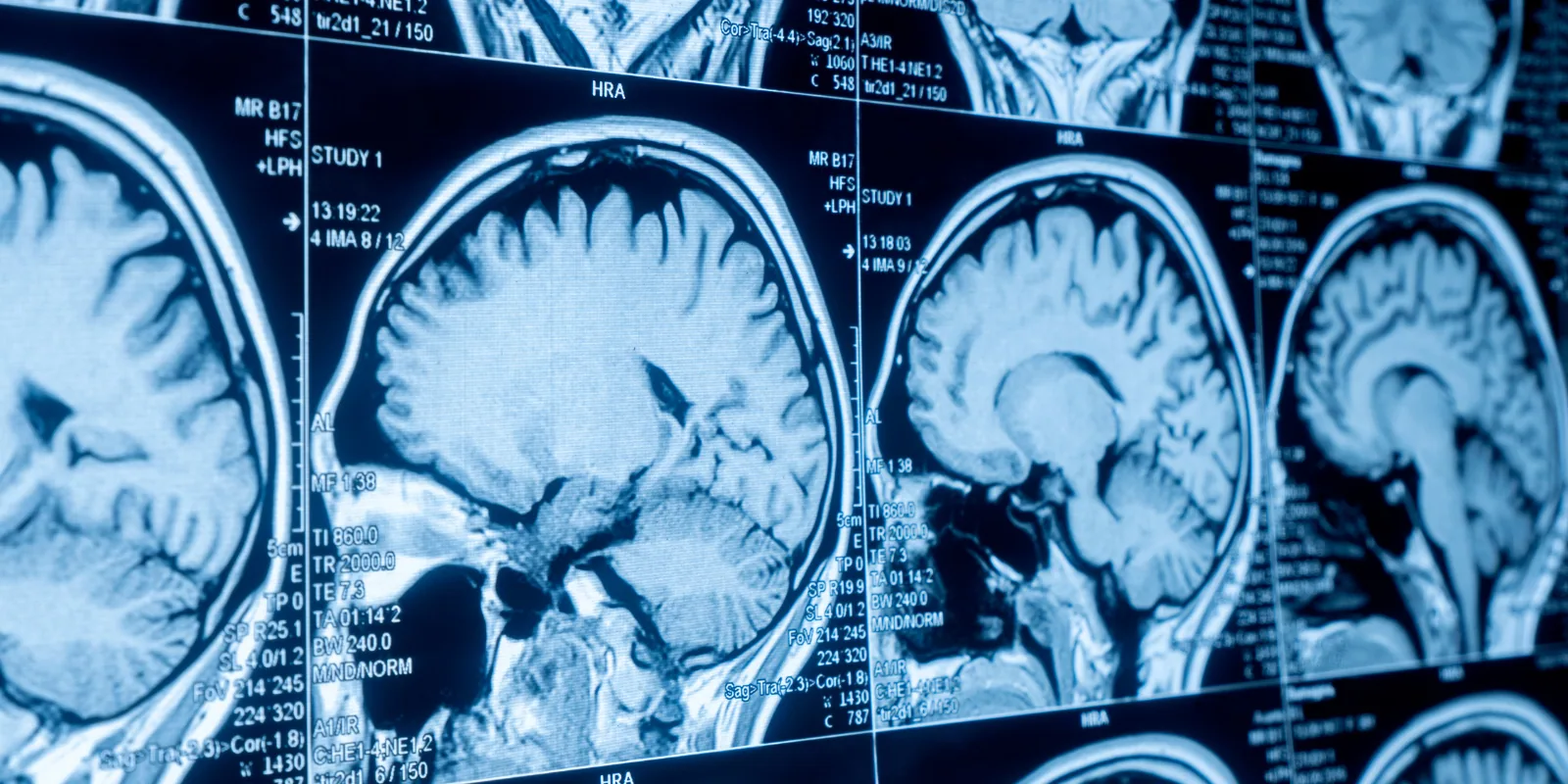 Adakah Anda Memerlukan MRI, Pengimejan Ultrasonik, atau Ujian Darah Sebelum Fisioterapi